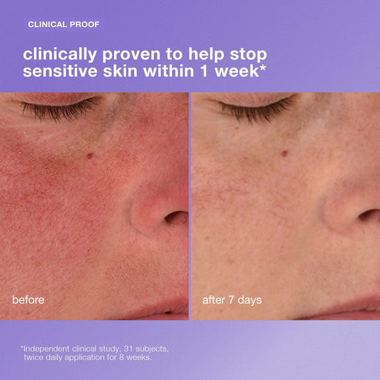 Stabilizing Repair Cream Crema hidratante para piel sensible Reduce la sensibilidad de la piel en 1 semana.