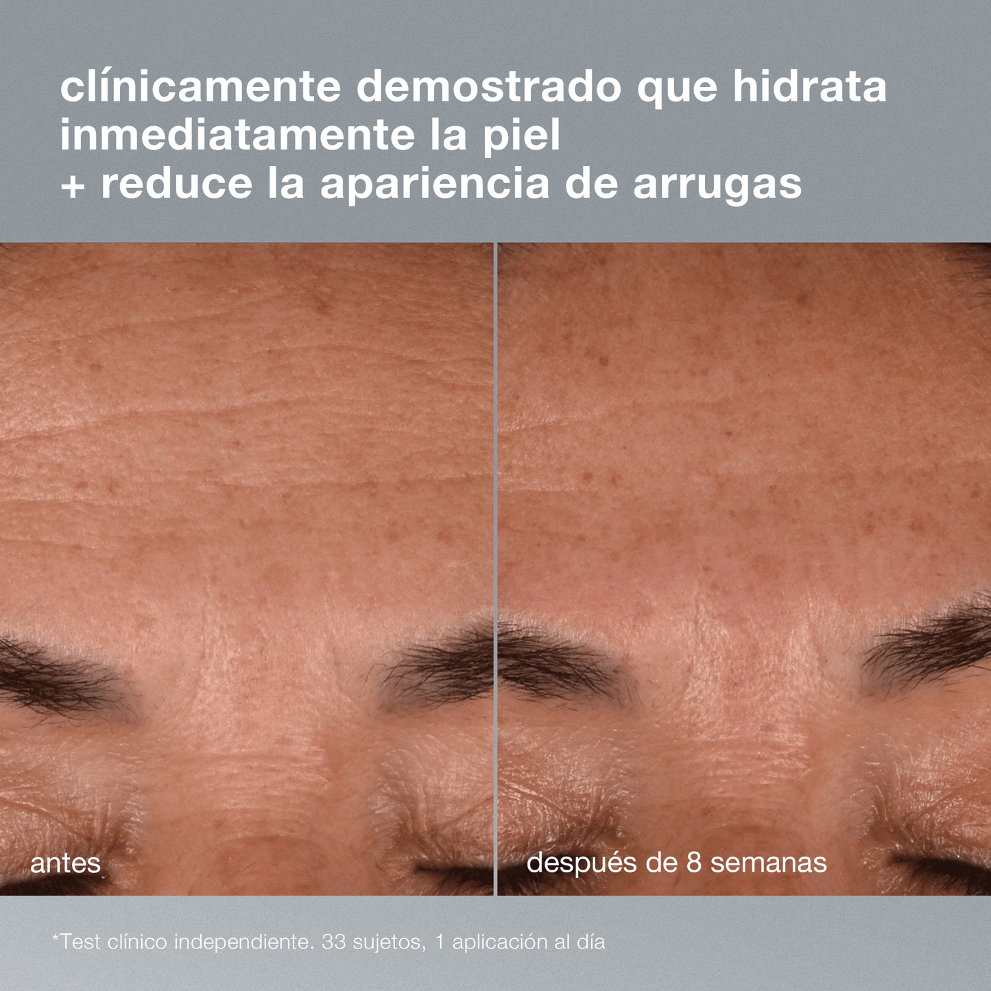 Dynamic Skin Recovery SPF50 Cuidado de día para piel madura Protege, minimiza arrugas, hidrata.