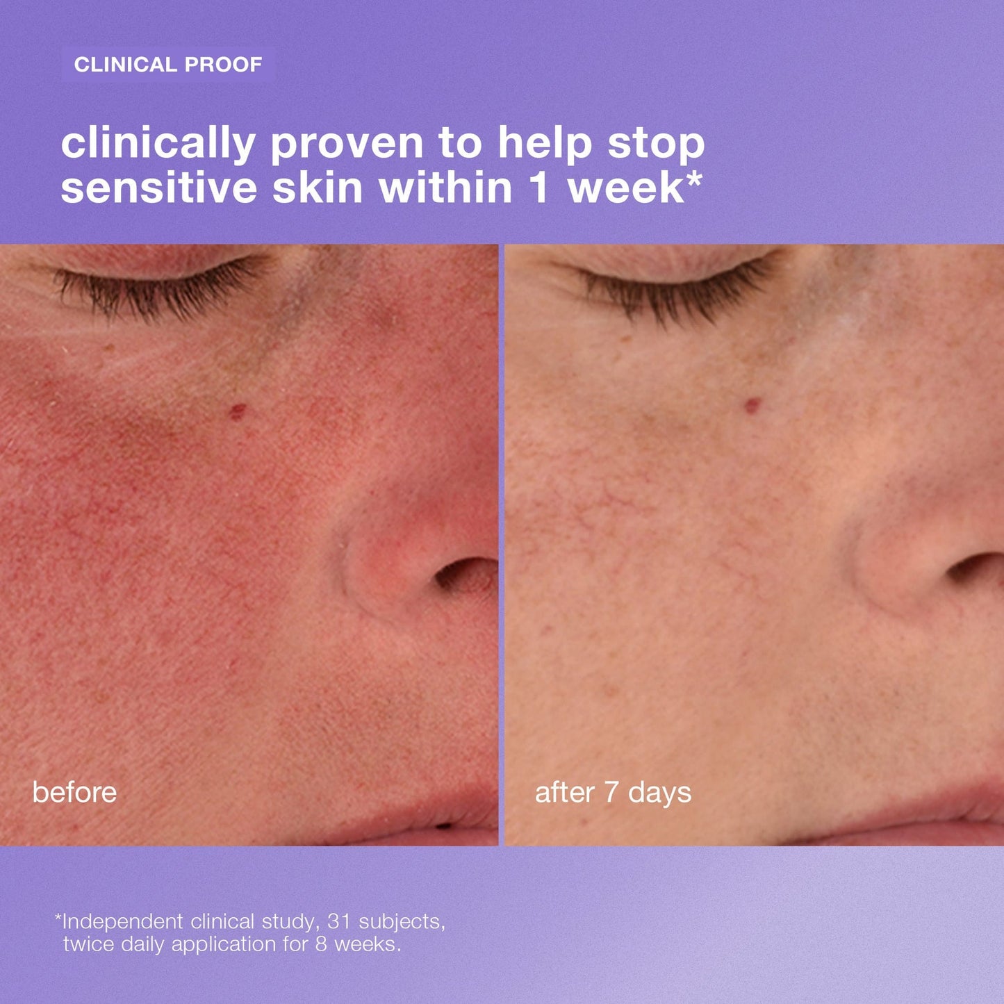 Stabilizing Repair Cream Crema hidratante para piel sensible Reduce la sensibilidad de la piel en 1 semana.