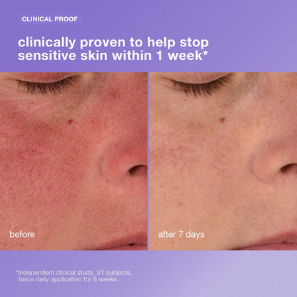 Stabilizing Repair Cream Crema hidratante para piel sensible Reduce la sensibilidad de la piel en 1 semana.